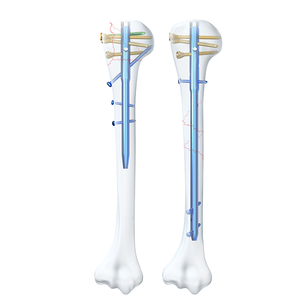 Geasure Stock Orthopedic Surgical Humeral Nail For Osteoporotic Bone Fixation Medical Orthopedic